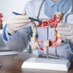Doctor pointing at anatomical model of the colon