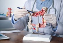 Doctor pointing at anatomical model of the colon