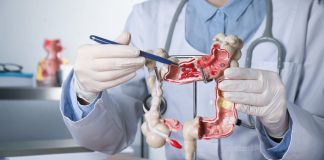 Doctor pointing at anatomical model of the colon