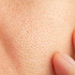 Close-up of skin with visible pores and finger