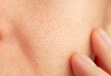 Close-up of skin with visible pores and finger