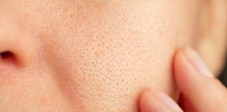Close-up of skin with visible pores and finger