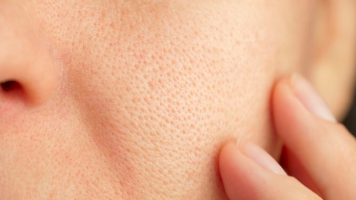 skincare_id_2431197707.jpg featured image Close-up of skin with visible pores and finger