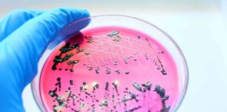 Gloved hand holding petri dish with bacterial colonies on pink agar